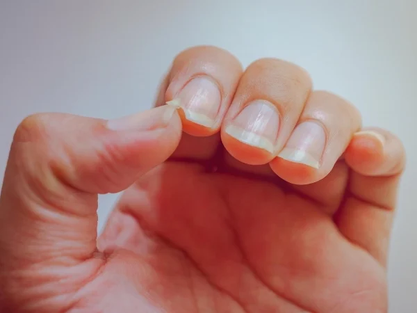 Co mówią paznokcie o zdrowiu – zmiany koloru, kształtu i tekstury